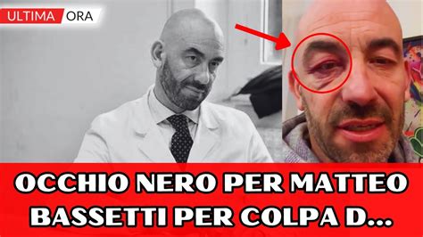 matteo bassetti rolex|Occhio nero per Bassetti, l'infettivologo spiega cosa succede e.